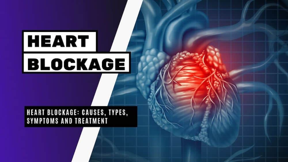 Heart Blockage Causes, Types, Symptoms and Treatment Bright Freak